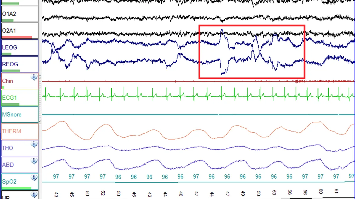 Polysomnography
